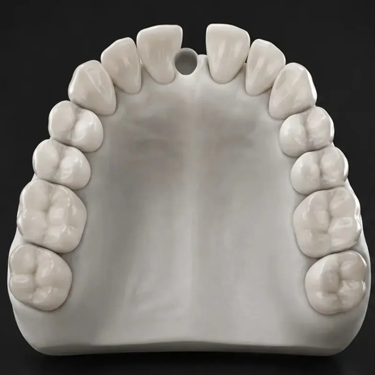 Single implant before